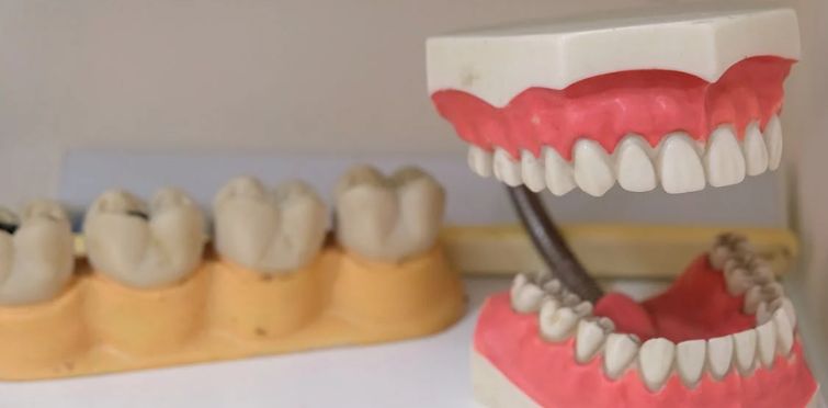 Técnico em Prótese Dentária: O que faz, Salário, Formação